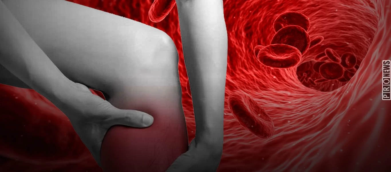 Προσοχή: Όσοι έχουν αυτή την ομάδα αίματος διατρέχουν μεγαλύτερο κίνδυνο θρόμβωσης (βίντεο)